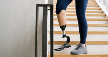 Amputee using prosthetic leg while climbing stairs.